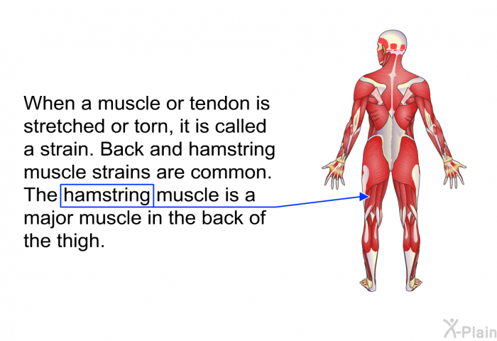 When a muscle or tendon is stretched or torn, it is called a strain. Back and hamstring muscle strains are common. The hamstring muscle is a major muscle in the back of the thigh.