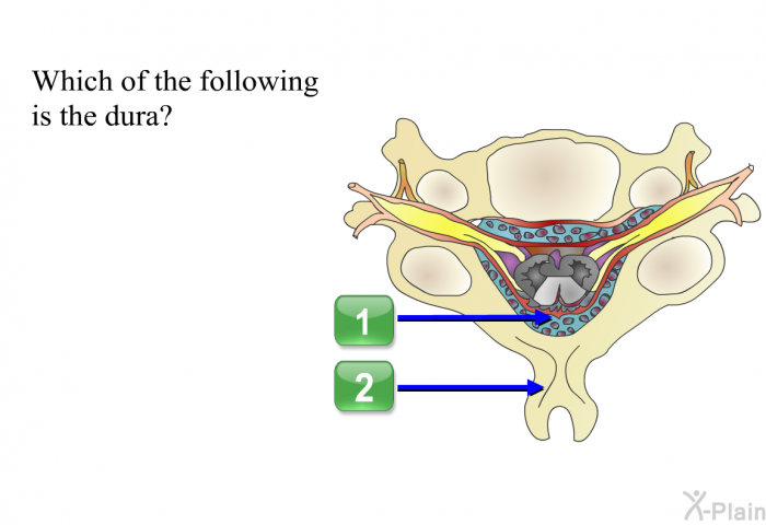 Which of the following is the dura?