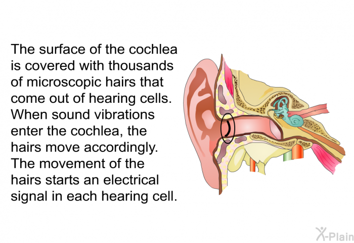 The surface of the cochlea is covered with thousands of microscopic hairs that come out of hearing cells. When sound vibrations enter the cochlea, the hairs move accordingly. The movement of the hairs starts an electrical signal in each hearing cell.