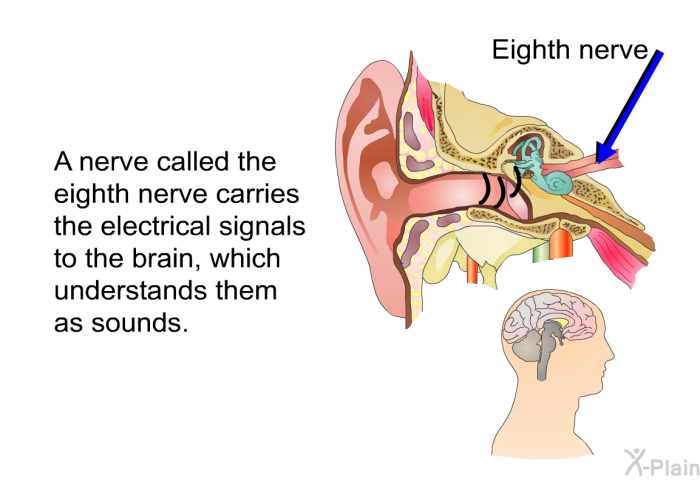 A nerve called the eighth nerve carries the electrical signals to the brain, which understands them as sounds.