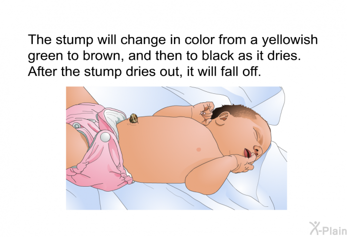 The stump will change in color from a yellowish green to brown, and then to black as it dries. After the stump dries out, it will fall off.