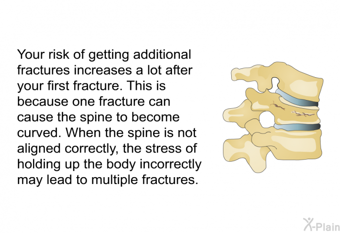 Your risk of getting additional fractures increases a lot after your first fracture. This is because one fracture can cause the spine to become curved. When the spine is not aligned correctly, the stress of holding up the body incorrectly may lead to multiple fractures.