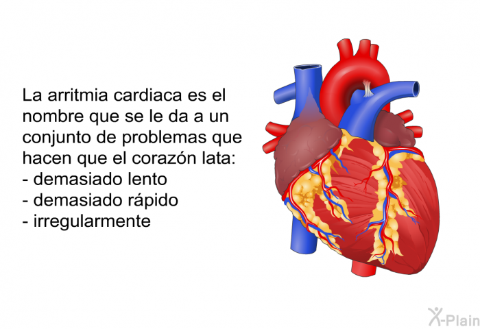 La arritmia cardiaca es el nombre que se le da a un conjunto de problemas que hacen que el corazn lata:  demasiado lento demasiado rpido irregularmente