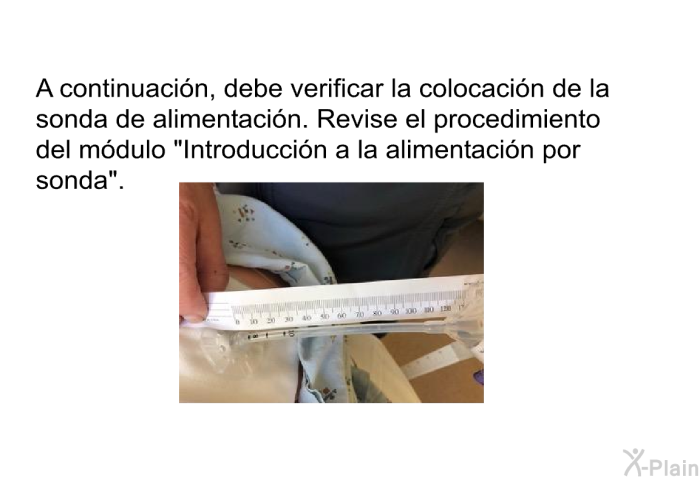 A continuacin, debe verificar la colocacin de la sonda de alimentacin. Revise el procedimiento del mdulo “Introduccin a la alimentacin por sonda”.