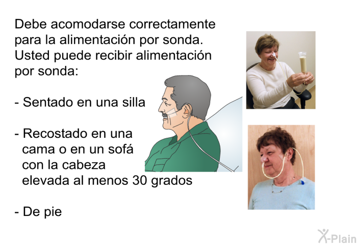 Debe acomodarse correctamente para la alimentacin por sonda. Usted puede recibir alimentacin por sonda:  Sentado en una silla  Recostado en una cama o en un sof con la cabeza elevada al menos 30 grados De pie