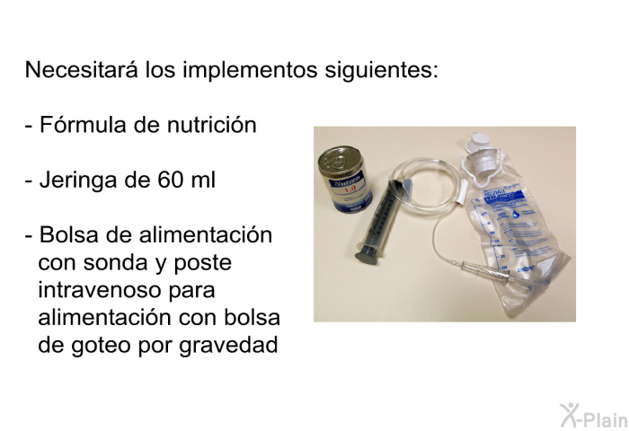 Necesitar los implementos siguientes:  Frmula de nutricin Jeringa de 60 ml Bolsa de alimentacin con sonda y poste intravenoso para alimentacin con bolsa de goteo por gravedad