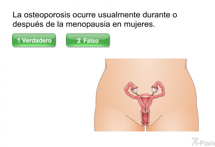 La osteoporosis ocurre usualmente durante o despus de la menopausia en mujeres.