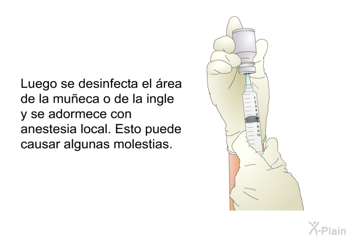 Luego se desinfecta el rea de la mueca o de la ingle y se adormece con anestesia local. Esto puede causar algunas molestias.