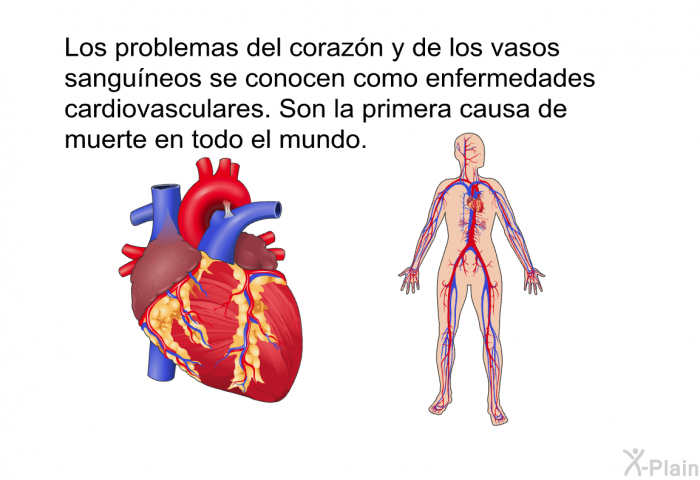 Los problemas del corazn y de los vasos sanguneos se conocen como enfermedades cardiovasculares. Son la primera causa de muerte en todo el mundo.