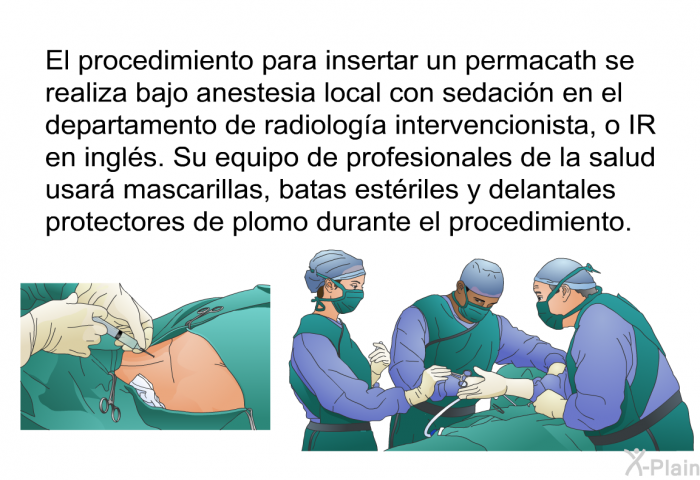 El procedimiento para insertar un <I>permacath</I> se realiza bajo anestesia local con sedacin en el departamento de radiologa intervencionista, o IR en ingls. Su equipo de profesionales de la salud usar mascarillas, batas estriles y delantales protectores de plomo durante el procedimiento.