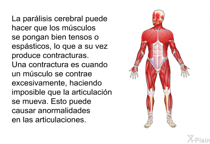 La parlisis cerebral puede hacer que los msculos se pongan bien tensos o espsticos, lo que a su vez produce contracturas. Una contractura es cuando un msculo se contrae excesivamente, haciendo imposible que la articulacin se mueva. Esto puede causar anormalidades en las articulaciones.