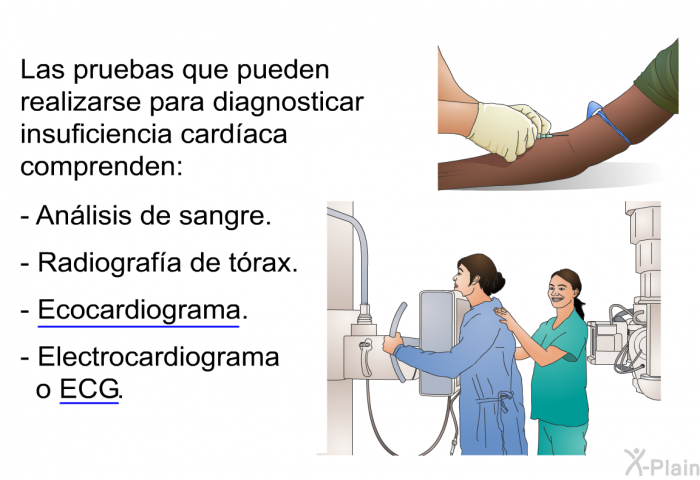 ecocardiograma de insuficiencia cardiaca