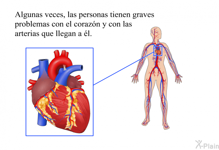 Algunas veces, las personas tienen graves problemas con el corazn y con las arterias que llegan a l.
