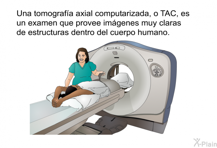 Una tomografa axial computarizada, o TAC, es un examen que provee imgenes muy claras de estructuras dentro del cuerpo humano.