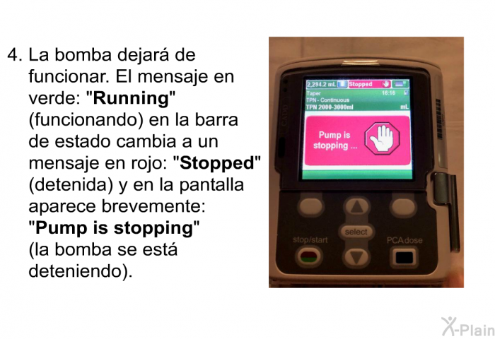 La bomba dejar de funcionar. El mensaje en verde: “<B>Running</B>” (funcionando) en la barra de estado cambia a un mensaje en rojo: “<B>Stopped</B>” (detenida) y en la pantalla aparece brevemente: “<B>Pump is stopping</B>” (la bomba se est deteniendo).