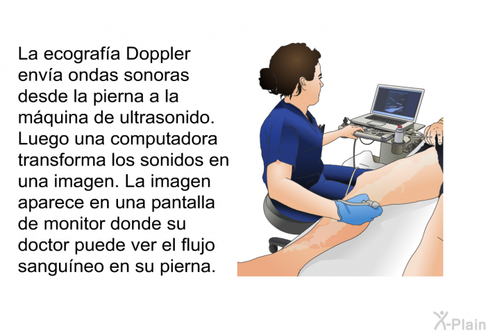 La ecografa Doppler enva ondas sonoras desde la pierna a la mquina de ultrasonido. Luego una computadora transforma los sonidos en una imagen. La imagen aparece en una pantalla de monitor donde su doctor puede ver el flujo sanguneo en su pierna.
