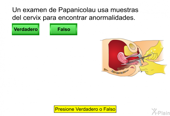 Un examen de Papanicolau usa muestras del c�rvix para encontrar anormalidades.