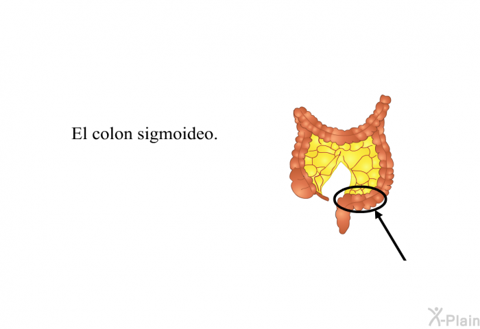 El colon sigmoideo