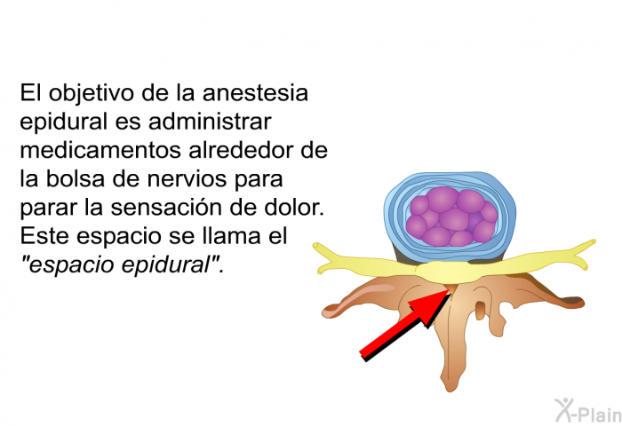 El objetivo de la anestesia epidural es administrar medicamentos alrededor de la bolsa de nervios para parar la sensacin de dolor. Este espacio se llama el “<I>espacio epidural”</I>.