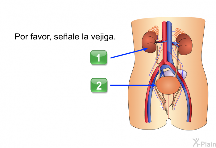 Por favor, seale la vejiga.