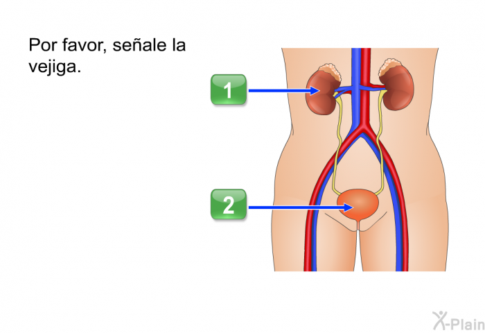 Por favor, seale la vejiga.