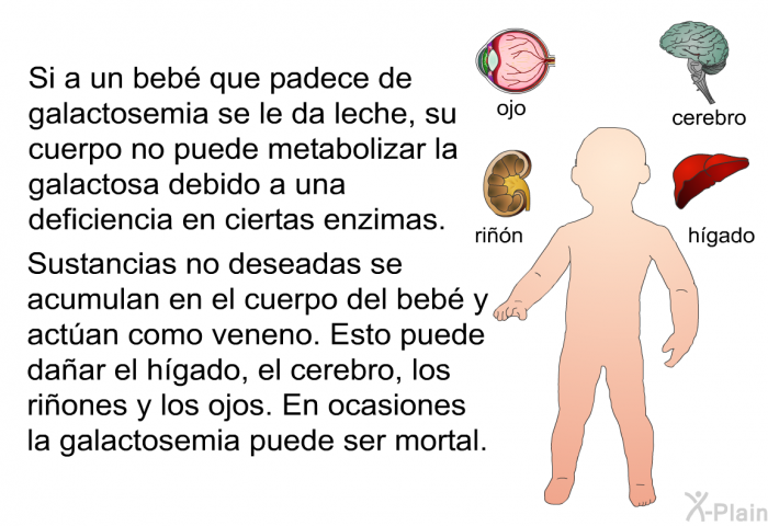 Si a un beb que padece de galactosemia se le da leche, su cuerpo no puede metabolizar la galactosa debido a una deficiencia en ciertas enzimas. Sustancias no deseadas se acumulan en el cuerpo del beb y actan como veneno. Esto puede daar el hgado, el cerebro, los riones y los ojos. En ocasiones la galactosemia puede ser mortal.