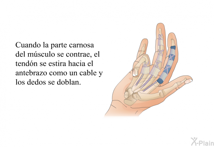 Cuando la parte carnosa del msculo se contrae, el tendn se estira hacia el antebrazo como un cable y los dedos se doblan.