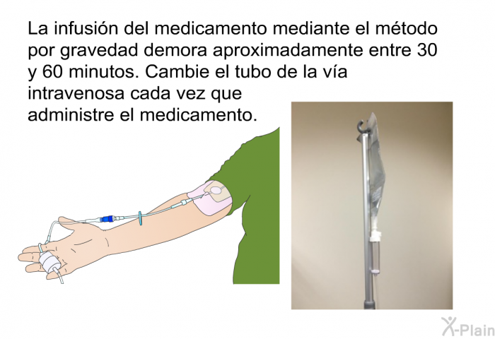 La infusin del medicamento mediante el mtodo por gravedad demora aproximadamente entre 30 y 60 minutos. Cambie el tubo de la va intravenosa cada vez que administre el medicamento.