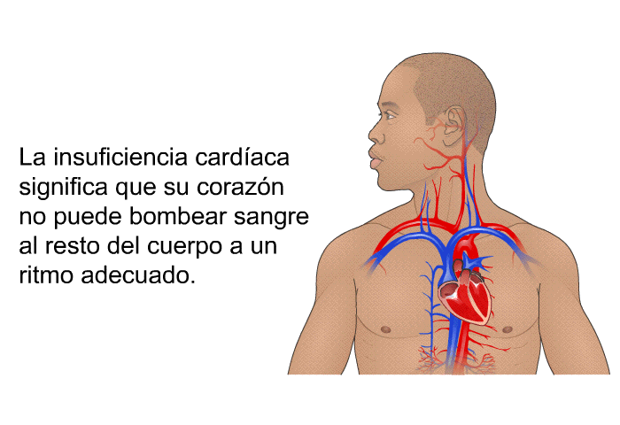 La insuficiencia cardaca significa que su corazn no puede bombear sangre al resto del cuerpo a un ritmo adecuado.