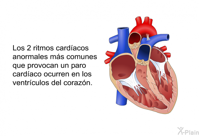 Los 2 ritmos cardacos anormales ms comunes que provocan un paro cardaco ocurren en los ventrculos del corazn. 