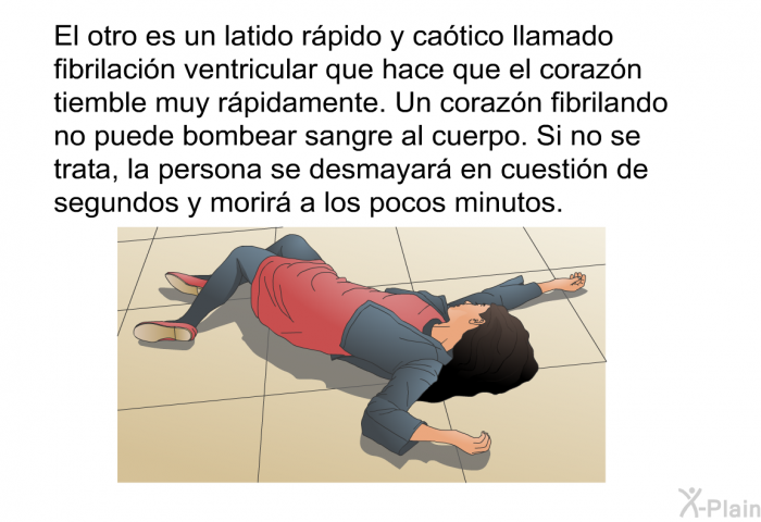 El otro es un latido rpido y catico llamado fibrilacin ventricular que hace que el corazn tiemble muy rpidamente. Un corazn fibrilando no puede bombear sangre al cuerpo. Si no se trata, la persona se desmayar en cuestin de segundos y morir a los pocos minutos.