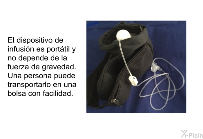 El dispositivo de infusin es porttil y no depende de la fuerza de gravedad. Una persona puede transportarlo en una bolsa con facilidad.