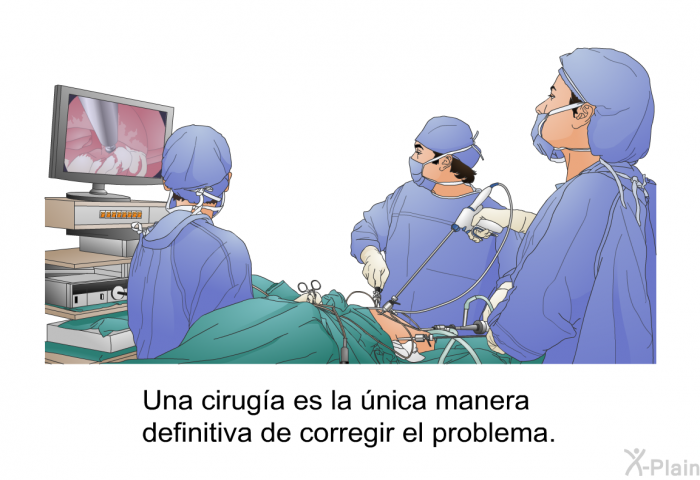 Una ciruga es la nica manera definitiva de corregir el problema.