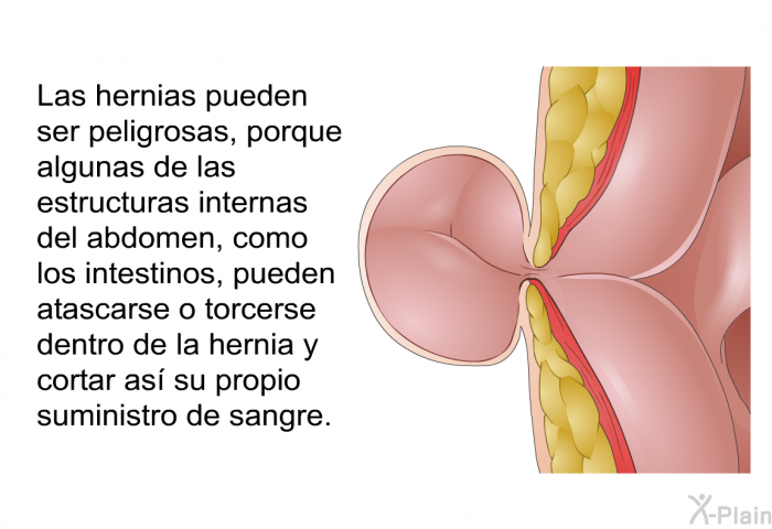 Las hernias pueden ser peligrosas, porque algunas de las estructuras internas del abdomen, como los intestinos, pueden atascarse o torcerse dentro de la hernia y cortar as su propio suministro de sangre.