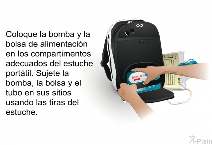 Coloque la bomba y la bolsa de alimentacin en los compartimentos adecuados del estuche porttil. Sujete la bomba, la bolsa y el tubo en sus sitios usando las tiras del estuche.