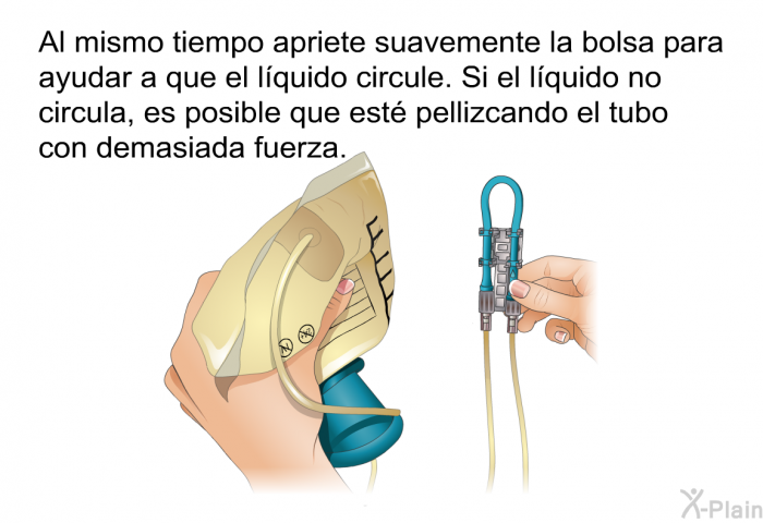 Al mismo tiempo apriete suavemente la bolsa para ayudar a que el lquido circule. Si el lquido no circula, es posible que est pellizcando el tubo con demasiada fuerza.