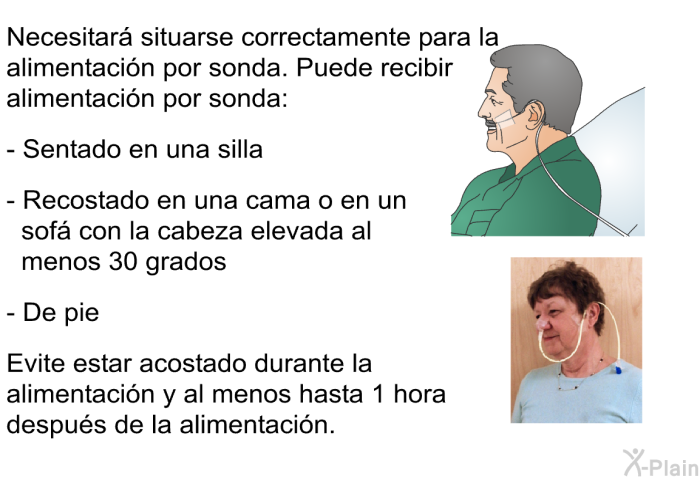 Necesitar situarse correctamente para la alimentacin por sonda. Puede recibir alimentacin por sonda:  Sentado en una silla Recostado en una cama o en un sof con la cabeza elevada al menos 30 grados De pie  
 Evite estar acostado durante la alimentacin y al menos hasta 1 hora despus de la alimentacin.