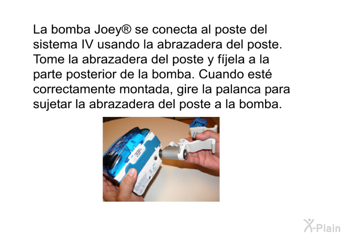 La bomba Joey<SUP> </SUP> se conecta al poste del sistema IV usando la abrazadera del poste. Tome la abrazadera del poste y fjela a la parte posterior de la bomba. Cuando est correctamente montada, gire la palanca para sujetar la abrazadera del poste a la bomba.