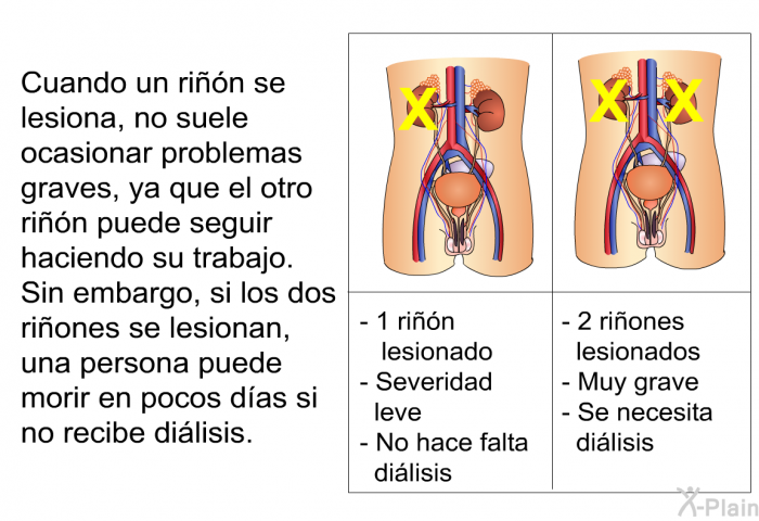 Cuando un rin se lesiona, no suele ocasionar problemas graves, ya que el otro rin puede seguir haciendo su trabajo. Sin embargo, si los dos riones se lesionan, una persona puede morir en pocos das si no recibe dilisis.