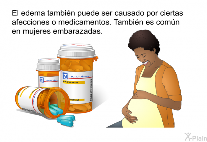 El edema tambin puede ser causado por ciertas afecciones o medicamentos. Tambin es comn en mujeres embarazadas.