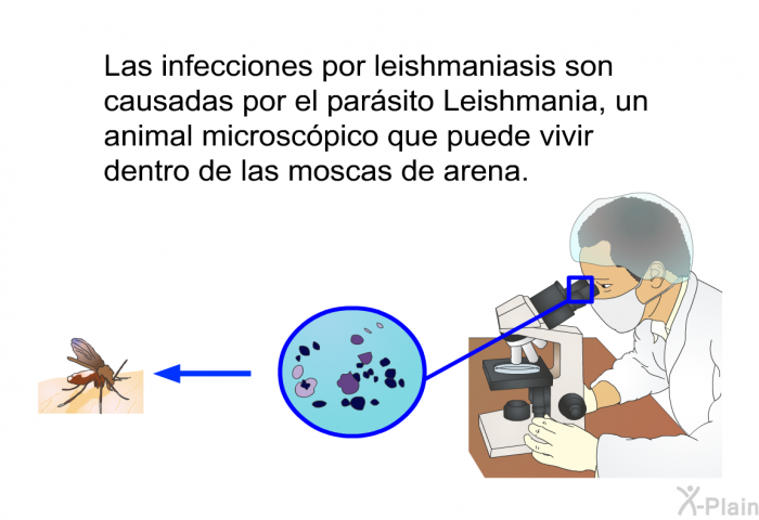 Las infecciones por leishmaniasis son causadas por el parsito Leishmania, un animal microscpico que puede vivir dentro de las moscas de arena.