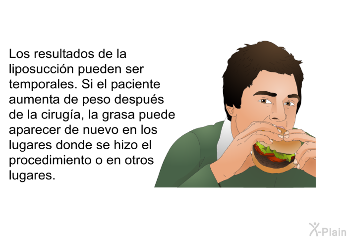 Los resultados de la liposuccin pueden ser temporales. Si el paciente aumenta de peso despus de la ciruga, la grasa puede aparecer de nuevo en los lugares donde se hizo el procedimiento o en otros lugares.