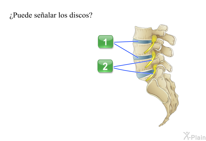 ¿Puede sealar los discos?