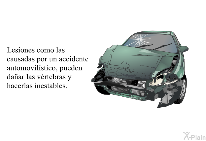 Lesiones como las causadas por un accidente automovilstico, pueden daar las vrtebras y hacerlas inestables.