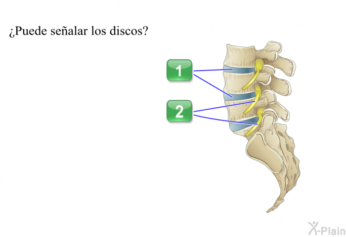 ¿Puede sealar los discos?