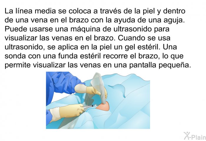 La lnea media se coloca a travs de la piel y dentro de una vena en el brazo con la ayuda de una aguja. Puede usarse una mquina de ultrasonido para visualizar las venas en el brazo. Cuando se usa ultrasonido, se aplica en la piel un gel estril. Una sonda con una funda estril recorre el brazo, lo que permite visualizar las venas en una pantalla pequea.