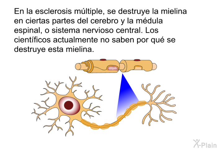 En la esclerosis mltiple, se destruye la mielina en ciertas partes del cerebro y la mdula espinal, o sistema nervioso central. Los cientficos actualmente no saben por qu se destruye esta mielina.