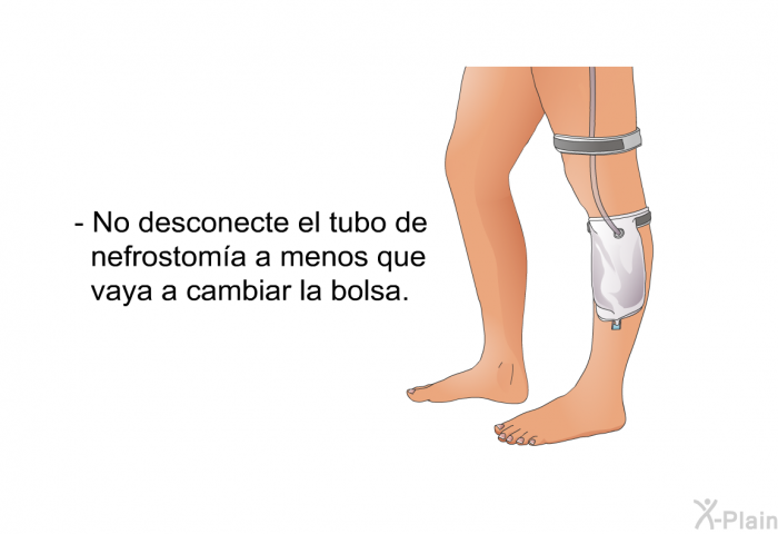 No desconecte el tubo de nefrostoma a menos que vaya a cambiar la bolsa.