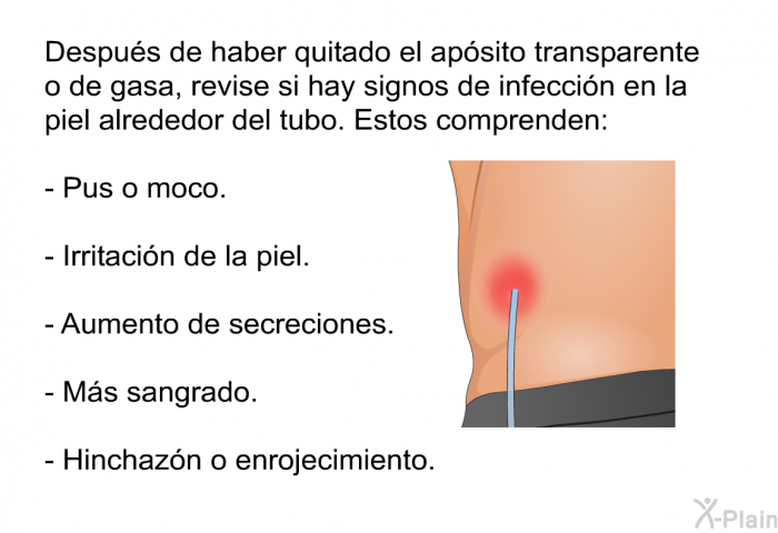 Despus de haber quitado el apsito transparente o de gasa, revise si hay signos de infeccin en la piel alrededor del tubo. Estos comprenden:  Pus o moco. Irritacin de la piel. Aumento de secreciones. Ms sangrado. Hinchazn o enrojecimiento.