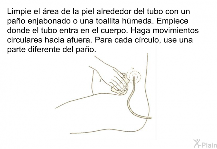 Limpie el rea de la piel alrededor del tubo con un pao enjabonado o una toallita hmeda. Empiece donde el tubo entra en el cuerpo. Haga movimientos circulares hacia afuera. Para cada crculo, use una parte diferente del pao.